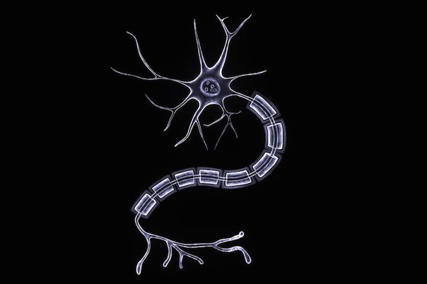 nervnye kletki vosstanavlivayutsya Нервные клетки восстанавливаются