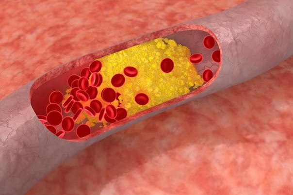 10 neveroyatnyh sposobnostei poluchennyh blagodarya redkim geneticheskim mutaciyam 10 невероятных способностей, полученных благодаря редким генетическим мутациям