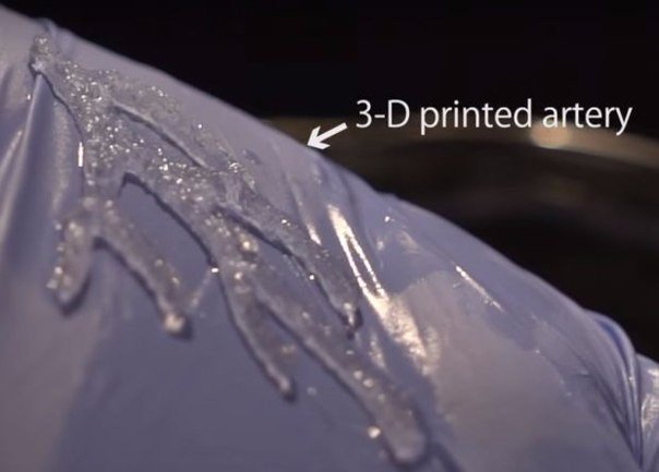 obychnye 3D printery prisposobili dlya pechati arterii Обычные 3D принтеры приспособили для печати артерий