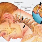 Восемь упражнений против шейного остеохондроза