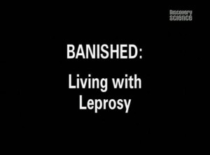 discoverybanished 300x222 Изгои. Жизнь прокажённых (Banished: Living with Leprosy)